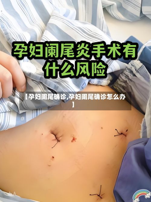 【孕妇阑尾确诊,孕妇阑尾确诊怎么办】-第3张图片
