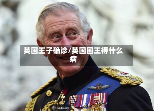 英国王子确诊/英国国王得什么病-第1张图片